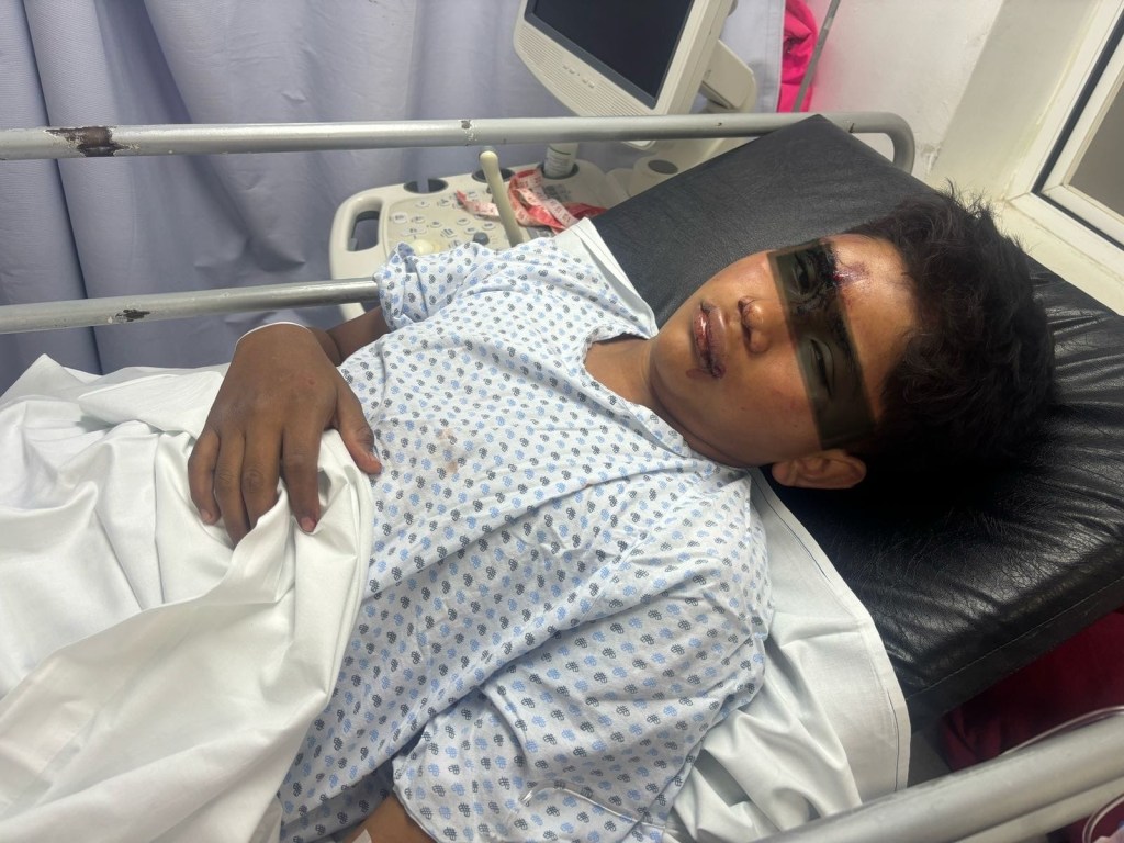 Trasladan a Veracruz a niño de 14 años agredido brutalmente en&nbsp;Tlalixcoyan